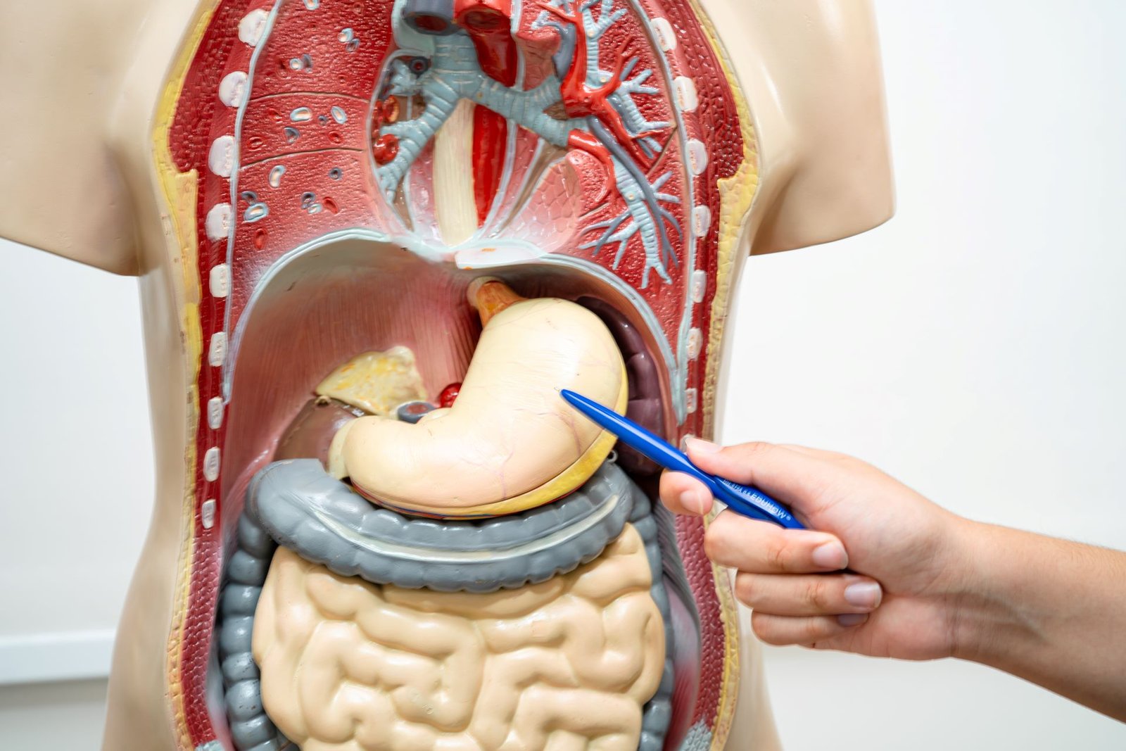 Laparoscopic Gastric Bypass