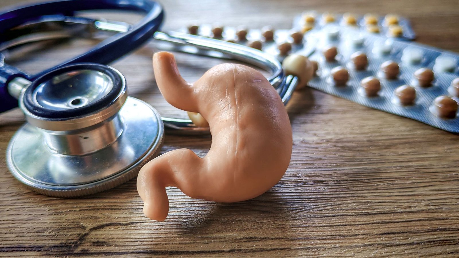 Laparoscopic Mini Gastric Bypass